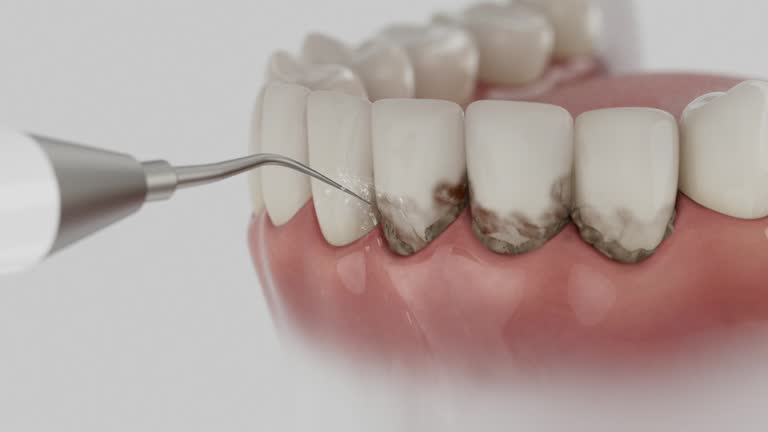 Reliable Dental Implants contractor in Boonville, IN by Smile Center Dentistry